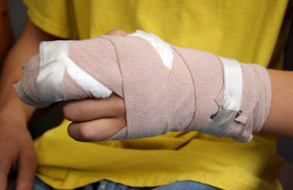 Burn Injury Lawyer In Austin, Texas 1 Burn Injury Lawyer In Austin, Texas