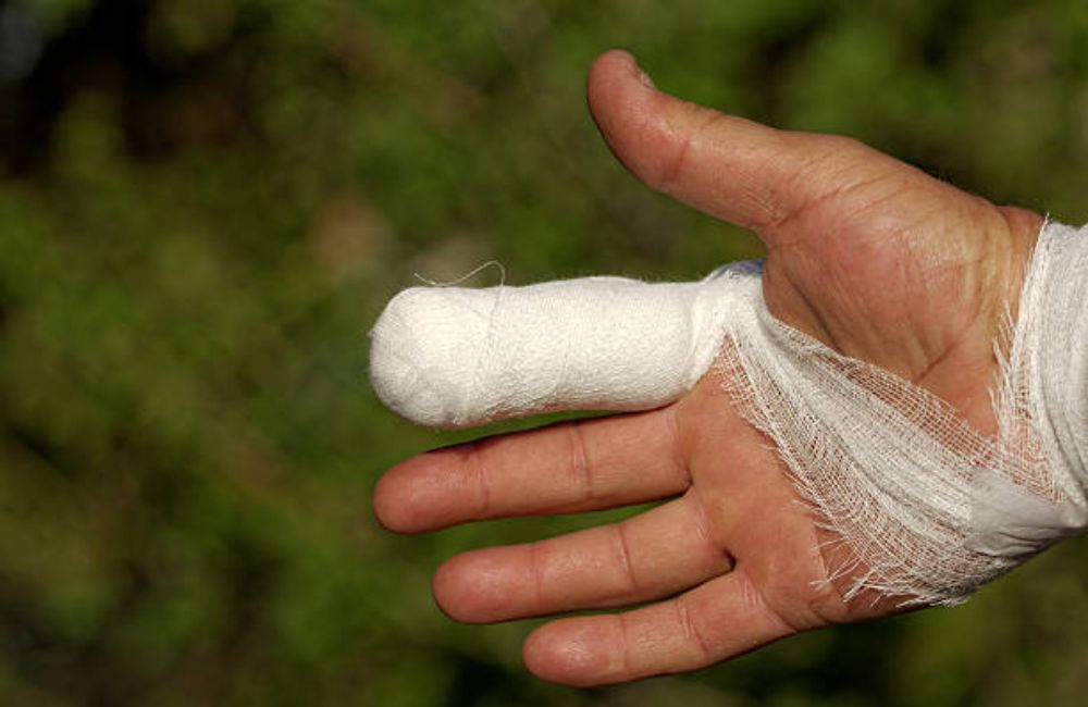 Burn Injury Lawyer In Austin, Texas 3 Burn Injury Lawyer In Austin, Texas