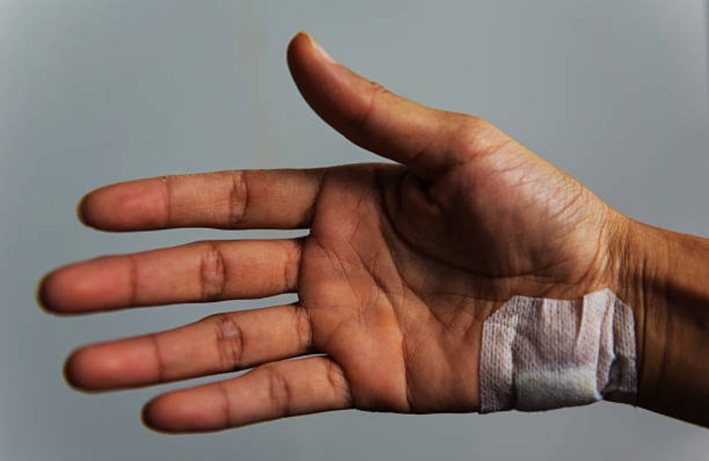 Burn Injury Lawyer In Austin, Texas 4 Burn Injury Lawyer In Austin, Texas