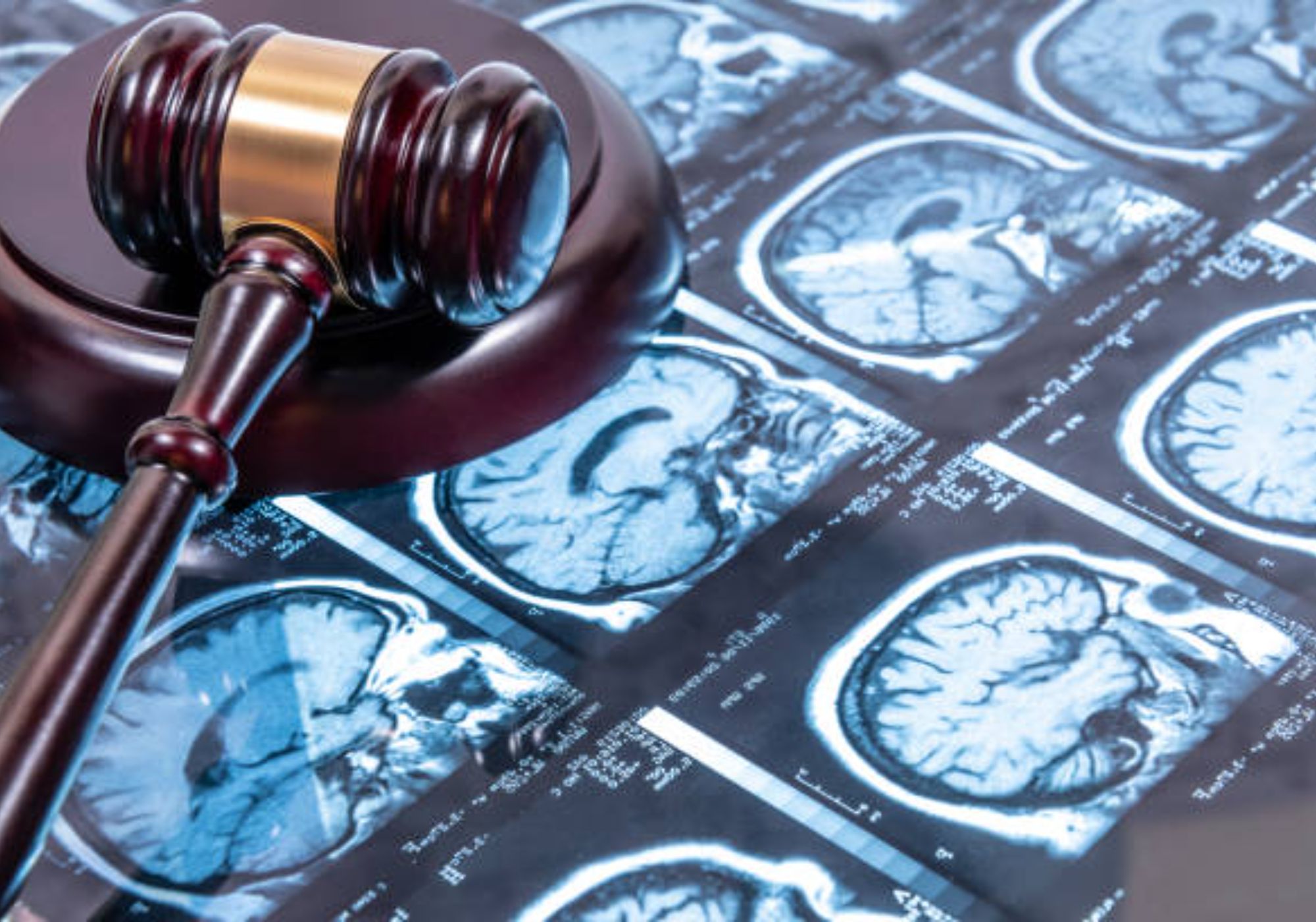 Traumatic Brain Injury Lawyer In Austin, Texas Hero Traumatic Brain Injury Lawyer In Austin, Texas